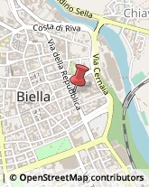 Agopuntura,13900Biella