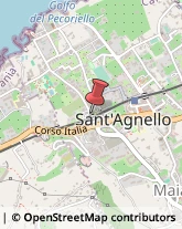 Articoli per Ortopedia Sant'Agnello,80065Napoli