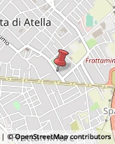 Articoli per Ortopedia Orta di Atella,81030Caserta