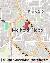 Oculisti - Medici Specialisti Melito di Napoli,80017Napoli