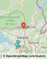 Osteopatia,21022Varese