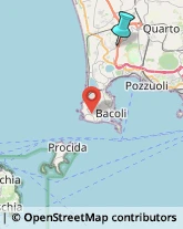 Ottica, Occhiali e Lenti a Contatto - Dettaglio,80078Napoli