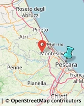 Oculisti - Medici Specialisti,65123Pescara