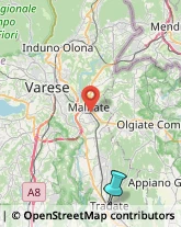 Agopuntura,21049Varese