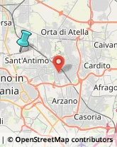 Consulenze Speciali,81030Napoli