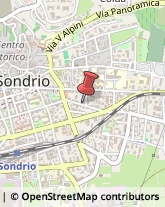 Articoli per Ortopedia Sondrio,23100Sondrio